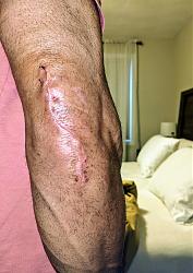 Click image for larger version

Name:	PXL_20201201_133112642~3.jpg
Views:	291
Size:	5.65 MB
ID:	1005491