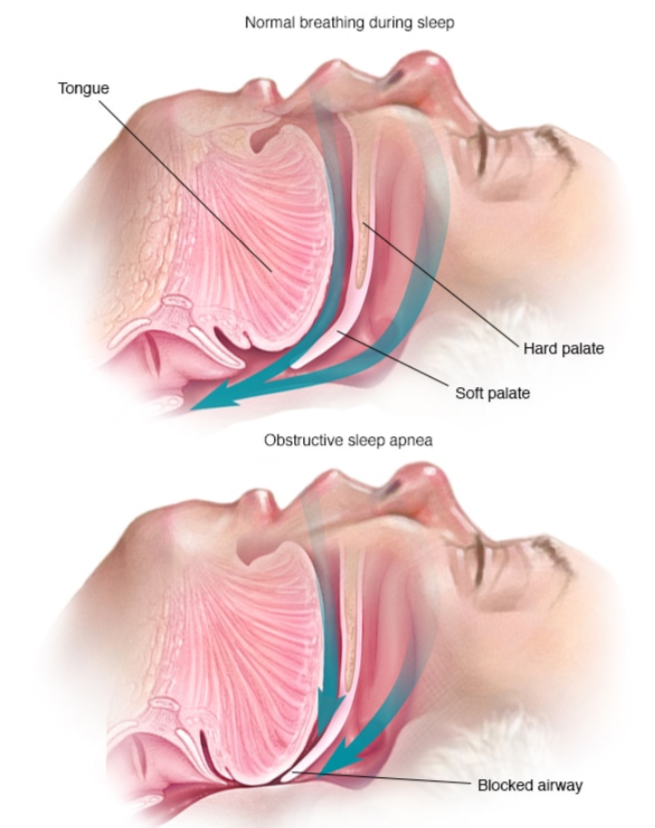 Click image for larger version  Name:	9xJmRlo.png Views:	0 Size:	483.7 KB ID:	993637