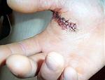 Click image for larger version

Name:	bad hand.jpg
Views:	457
Size:	30.8 KB
ID:	933029