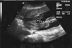 Click image for larger version

Name:	baby boy1.jpg
Views:	225
Size:	23.8 KB
ID:	933977