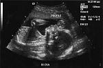 Click image for larger version

Name:	baby boy2.jpg
Views:	244
Size:	23.1 KB
ID:	933978