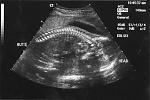 Click image for larger version

Name:	baby boy4.jpg
Views:	219
Size:	24.2 KB
ID:	933979
