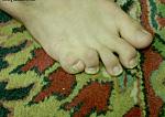 Click image for larger version

Name:	5551little_toe.jpg
Views:	243
Size:	31.4 KB
ID:	935091