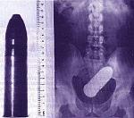 Click image for larger version

Name:	5551metal_butt.jpg
Views:	330
Size:	19.1 KB
ID:	935691