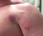 Click image for larger version

Name:	EME_tear2.jpg
Views:	329
Size:	94.1 KB
ID:	940963