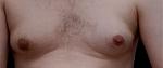 Click image for larger version

Name:	gyno.jpg
Views:	344
Size:	8.0 KB
ID:	943387