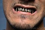 Click image for larger version

Name:	young-man-wearing-teeth-grill-~-IE068-024.jpg
Views:	302
Size:	18.5 KB
ID:	943892