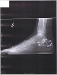 Click image for larger version

Name:	Foot Repair.jpg
Views:	286
Size:	14.6 KB
ID:	944381
