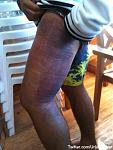 Click image for larger version

Name:	ouch.jpg
Views:	264
Size:	28.9 KB
ID:	944811