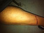 Click image for larger version

Name:	leg.jpg
Views:	232
Size:	42.5 KB
ID:	944952