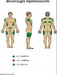 Click image for larger version

Name:	injectionsstellen.jpg
Views:	365
Size:	107.4 KB
ID:	948502