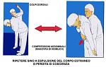 Click image for larger version

Name:	heimlich.jpg
Views:	335
Size:	34.6 KB
ID:	949179