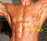 Click image for larger version

Name:	gyno.JPG
Views:	343
Size:	10.3 KB
ID:	950328