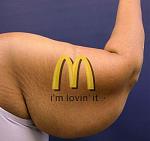 Click image for larger version

Name:	McFat-arm.jpg
Views:	310
Size:	16.8 KB
ID:	950490