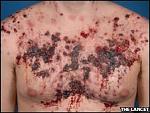 Click image for larger version

Name:	_44947686_steroid2.jpg
Views:	340
Size:	13.2 KB
ID:	950788