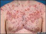 Click image for larger version

Name:	_44947687_steroid3.jpg
Views:	350
Size:	10.2 KB
ID:	950789