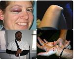 Click image for larger version

Name:	12.16.06---wii-injuries.jpg
Views:	172
Size:	58.9 KB
ID:	950869