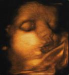 Click image for larger version

Name:	Madison.jpg
Views:	231
Size:	470.3 KB
ID:	951243