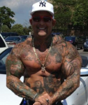 Derek Anthony after years of steroid abuse and organ failure. He started using synthol.