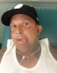 Derek Anthony once his kidneys had failed.